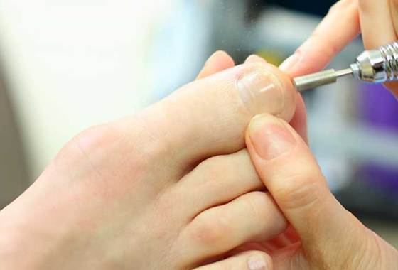 Best Toenail Correction Tools