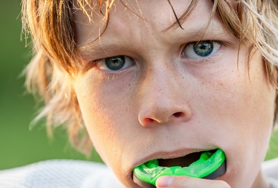 Best mouth guard